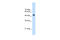 TRNA Methyltransferase 2 Homolog B antibody, 30-473, ProSci, Western Blot image 