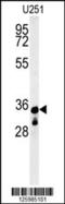 Beta-1,3-N-Acetylgalactosaminyltransferase 1 (Globoside Blood Group) antibody, LS-C156701, Lifespan Biosciences, Western Blot image 