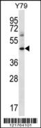 Interferon Gamma Receptor 1 antibody, 56-568, ProSci, Western Blot image 
