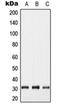 Gap Junction Protein Beta 5 antibody, orb215469, Biorbyt, Western Blot image 