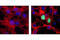 Poly(ADP-Ribose) Polymerase 1 antibody, 9544S, Cell Signaling Technology, Immunofluorescence image 