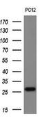 Transmembrane P24 Trafficking Protein 1 antibody, MA5-25700, Invitrogen Antibodies, Western Blot image 