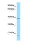 Dual Specificity Phosphatase 4 antibody, NBP1-98449, Novus Biologicals, Western Blot image 