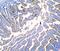 Sucrase-Isomaltase antibody, A04542-1, Boster Biological Technology, Immunohistochemistry paraffin image 