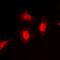 Protein Kinase C Iota antibody, orb393138, Biorbyt, Immunofluorescence image 