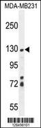 Zinc Finger SWIM-Type Containing 6 antibody, MBS9205146, MyBioSource, Western Blot image 