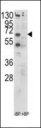Chaperonin Containing TCP1 Subunit 3 antibody, 61-581, ProSci, Western Blot image 