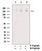 TEK Receptor Tyrosine Kinase antibody, GTX00794, GeneTex, Western Blot image 