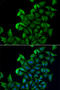 Fatty Acid Binding Protein 5 antibody, STJ28456, St John