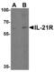 Interleukin-21 receptor antibody, 40104, QED Bioscience, Western Blot image 