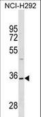 Tetraspanin 18 antibody, LS-C157288, Lifespan Biosciences, Western Blot image 