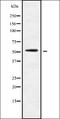 S100 Calcium Binding Protein A1 antibody, orb378199, Biorbyt, Western Blot image 