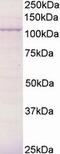 BCAR3 Adaptor Protein, NSP Family Member antibody, LS-C54573, Lifespan Biosciences, Western Blot image 