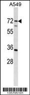 Cytidine And DCMP Deaminase Domain Containing 1 antibody, 58-392, ProSci, Western Blot image 