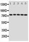 Heat Shock Protein Family A (Hsp70) Member 9 antibody, PA1789, Boster Biological Technology, Western Blot image 