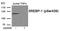 Sterol Regulatory Element Binding Transcription Factor 1 antibody, GTX55392, GeneTex, Western Blot image 