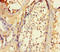 Brain mitochondrial carrier protein 1 antibody, A63430-100, Epigentek, Immunohistochemistry paraffin image 