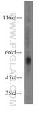 Cathepsin A antibody, 15020-1-AP, Proteintech Group, Western Blot image 