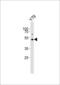 Acetylserotonin O-Methyltransferase antibody, LS-C156543, Lifespan Biosciences, Western Blot image 