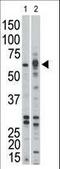 Activin A Receptor Type 1B antibody, LS-C97143, Lifespan Biosciences, Western Blot image 