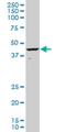 ALX Homeobox 1 antibody, H00008092-M02, Novus Biologicals, Western Blot image 