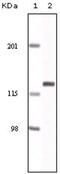 EPH Receptor A2 antibody, abx010719, Abbexa, Enzyme Linked Immunosorbent Assay image 