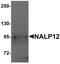 NLR Family Pyrin Domain Containing 12 antibody, PA5-21027, Invitrogen Antibodies, Western Blot image 