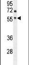 Adenosine A2a Receptor antibody, PA5-23969, Invitrogen Antibodies, Western Blot image 