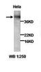 A-Kinase Anchoring Protein 10 antibody, orb77029, Biorbyt, Western Blot image 
