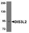 DIS3 Like 3'-5' Exoribonuclease 2 antibody, A07738, Boster Biological Technology, Western Blot image 