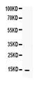 IL-4 antibody, PA5-79505, Invitrogen Antibodies, Western Blot image 