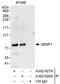 SUMO Specific Peptidase 1 antibody, A302-928A, Bethyl Labs, Immunoprecipitation image 