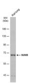 NUMB Endocytic Adaptor Protein antibody, PA5-78257, Invitrogen Antibodies, Western Blot image 