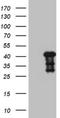 Myozenin 1 antibody, NBP2-46071, Novus Biologicals, Western Blot image 
