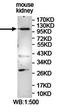 ALS2 C-Terminal Like antibody, orb77558, Biorbyt, Western Blot image 