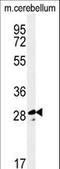 Tescalcin antibody, LS-C161804, Lifespan Biosciences, Western Blot image 