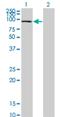 Scm Like With Four Mbt Domains 1 antibody, H00051460-M02, Novus Biologicals, Western Blot image 