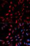 Carboxypeptidase E antibody, LS-C335573, Lifespan Biosciences, Immunofluorescence image 