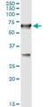 Cystathionine-Beta-Synthase antibody, H00000875-M02, Novus Biologicals, Immunoprecipitation image 