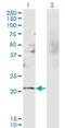 RNA Binding Motif Protein 8A antibody, H00009939-M08, Novus Biologicals, Western Blot image 