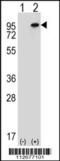 Nuclear Receptor Binding SET Domain Protein 3 antibody, 56-628, ProSci, Western Blot image 