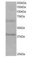 Ankyrin Repeat And BTB Domain Containing 1 antibody, orb18671, Biorbyt, Western Blot image 