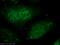 THO Complex 5 antibody, 14862-1-AP, Proteintech Group, Immunofluorescence image 