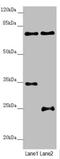 NEDD1 Gamma-Tubulin Ring Complex Targeting Factor antibody, LS-C676144, Lifespan Biosciences, Western Blot image 