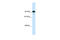 Class II Major Histocompatibility Complex Transactivator antibody, 28-570, ProSci, Western Blot image 