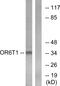 Olfactory Receptor Family 6 Subfamily T Member 1 antibody, GTX87986, GeneTex, Western Blot image 