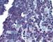 Linker For Activation Of T Cells antibody, 49-251, ProSci, Immunohistochemistry paraffin image 