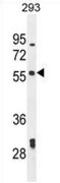 La Ribonucleoprotein Domain Family Member 6 antibody, AP52442PU-N, Origene, Western Blot image 