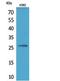 Fibroblast Growth Factor 16 antibody, A01859, Boster Biological Technology, Western Blot image 