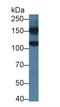 Glycine Decarboxylase antibody, LS-C299236, Lifespan Biosciences, Western Blot image 